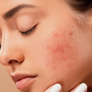 Soins Anti-imperfections