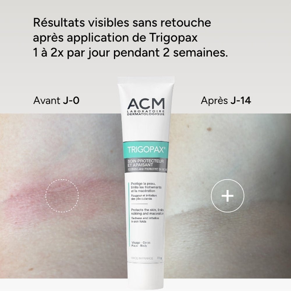acm – trigopax soin protecteur et apaisant – 40ml acm – trigopax soin protecteur et apaisant – 40ml