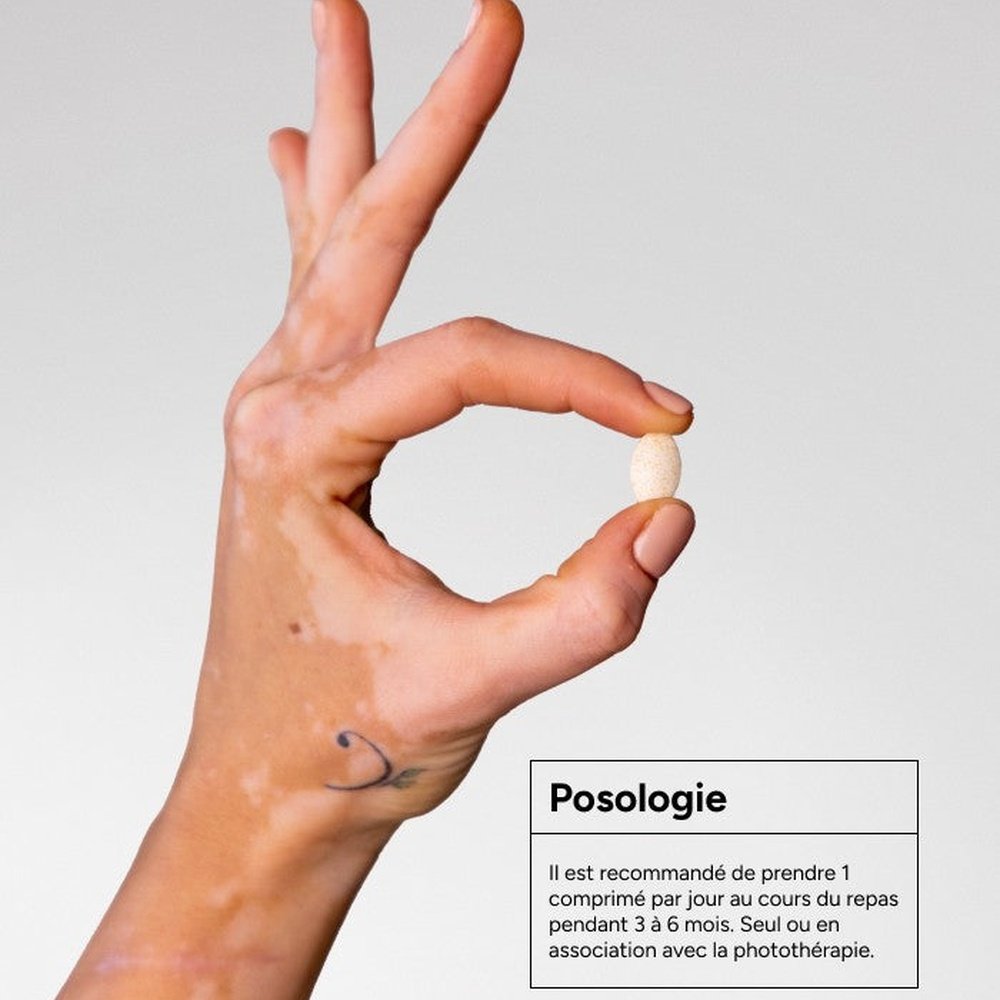 acm – vitix depigmentation et vitiligo – 30 comprimes acm – vitix depigmentation et vitiligo – 30 comprimes