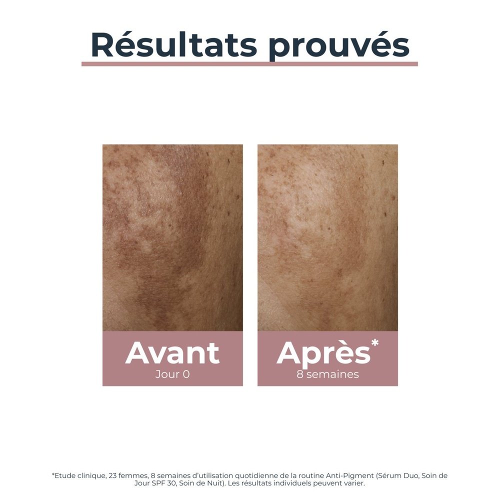 eucerin – anti pigment serum duo – 30ml eucerin – anti pigment serum duo – 30ml