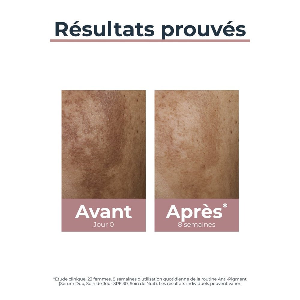 eucerin – anti pigment soin de jour spf30 – 50ml eucerin – anti pigment soin de jour spf30 – 50ml